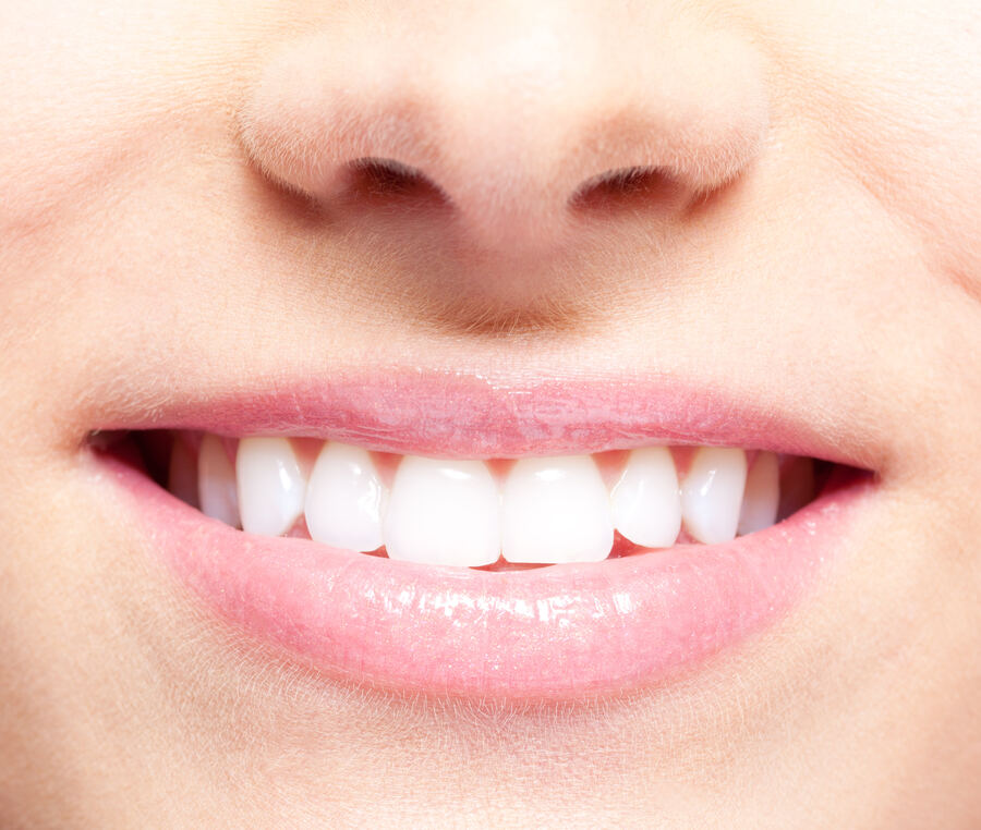 After dental crown