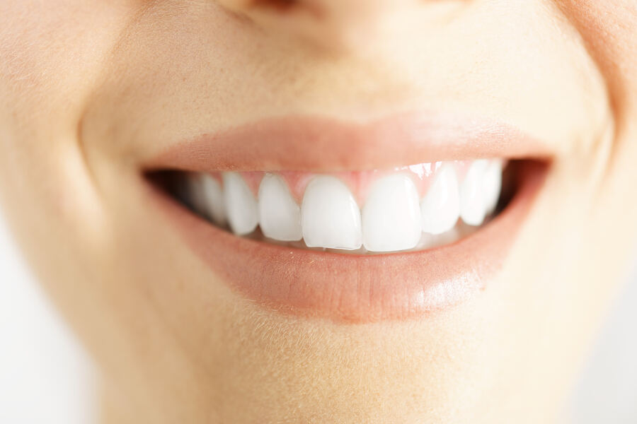 After dental implant